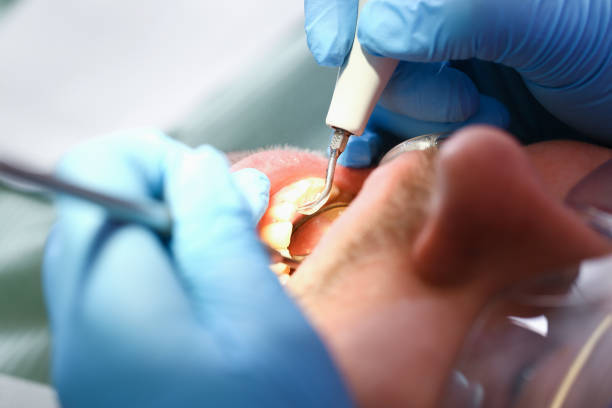 Best Urgent Dental Care for Toothache in Dahlgren, VA