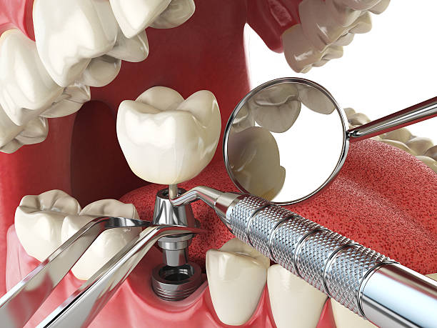 Best 24-Hour Emergency Dentist in Dahlgren, VA